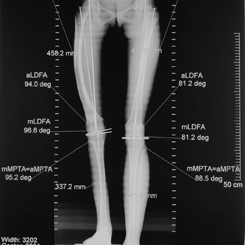 Armaveni_353x353Xray.jpg