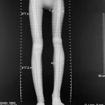 Armaveni_353x353_X-ray.jpg