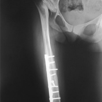 Varduhi_Xray.jpg